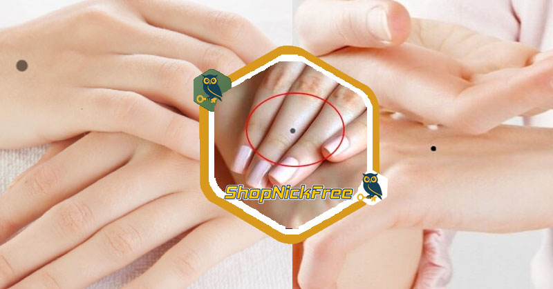 Nốt Ruồi Bàn Tay Quý Nhân Vượng Vận